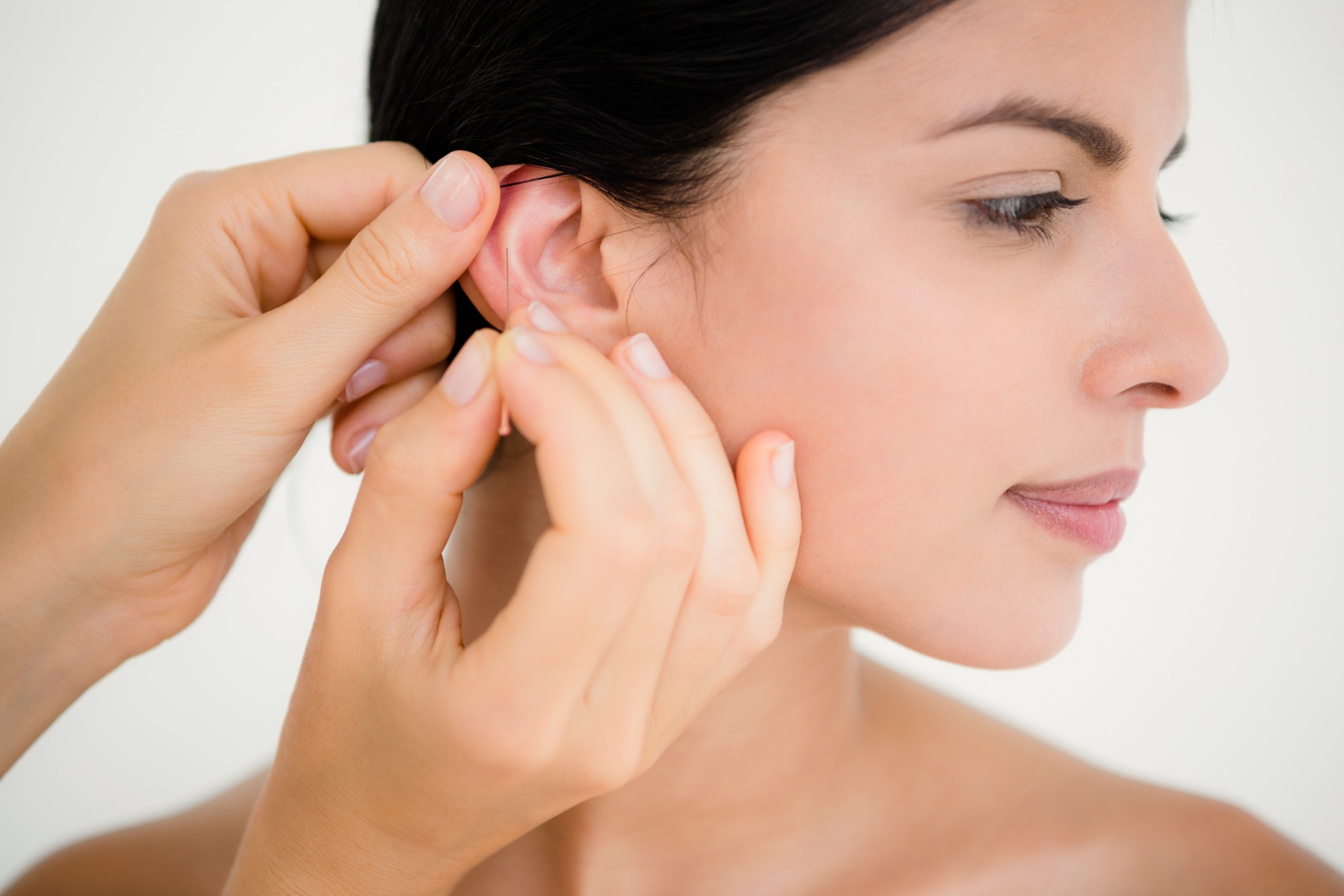 Ear Acupuncture